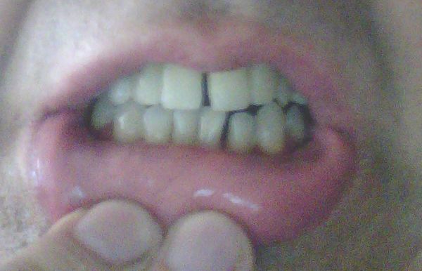 Чудеса белорусской стоматологии